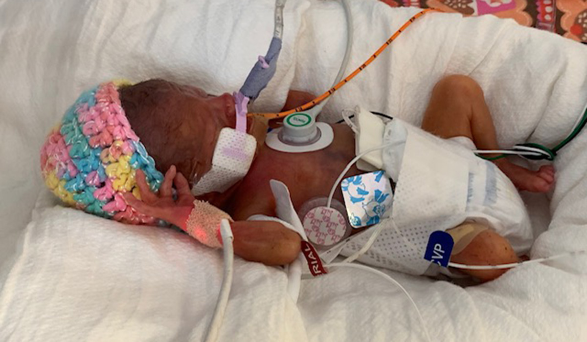 A Miracle Baby in NICU
